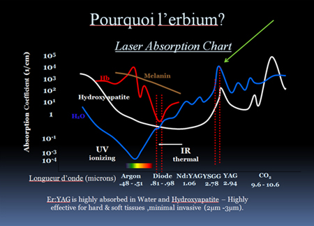 Graphique d'absorption du laser