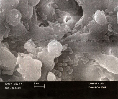 Contamination par bactéries planctoniques